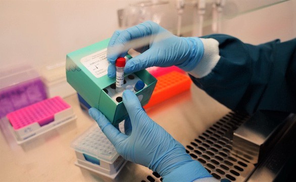越南成功研发两款新冠病毒核酸检测试剂盒