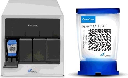结核病防治计划Gene Xpert 检测系统可参与新冠肺炎病毒检测