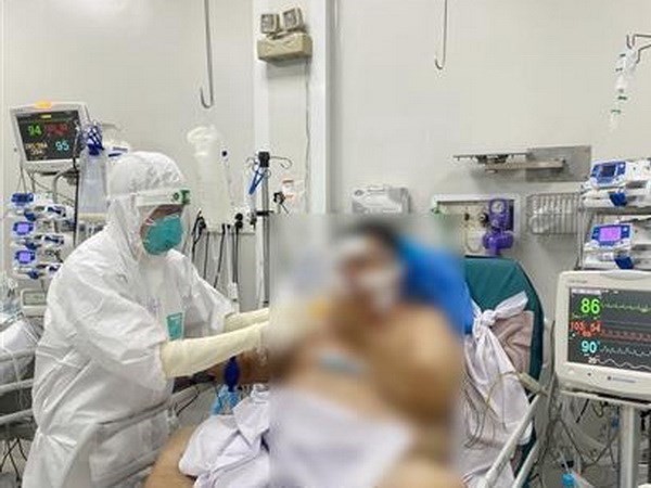 胡志明市积极为新冠肺炎危重症患者进行治疗