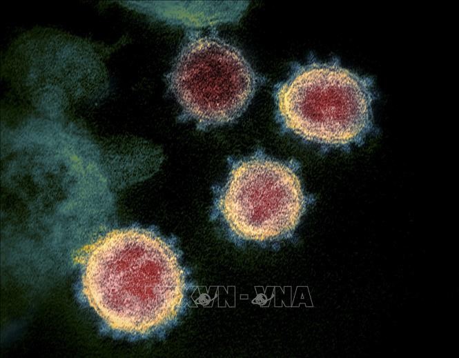 Hình ảnh nhìn qua kính hiển vi cho thấy virus SARS-CoV-2 (vật thể tròn màu xanh) nổi lên trên bề mặt tế bào bệnh nhân nhiễm COVID-19. Ảnh: AFP/TTXVN