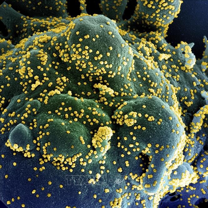 Hình ảnh quét qua kính hiển vi điện tử cho thấy một tế bào (màu xanh) bị virus SARS-COV-2 (màu vàng) xâm nhập, lấy từ mẫu bệnh phẩm của bệnh nhân COVID-19 tại Viện Nghiên cứu Dị ứng và Bệnh Truyền nhiễm Quốc gia, Fort Detrick, Maryland, Mỹ ngày 15/7/2020.