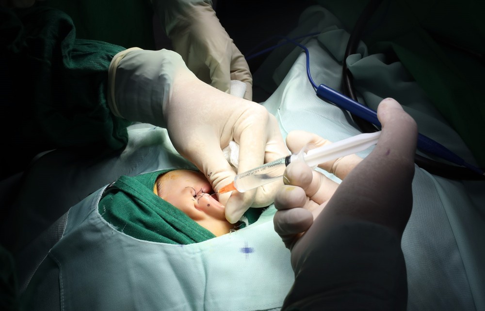 Hơn 700 trẻ em khuyết tật tỉnh Lạng Sơn được phẫu thuật miễn phí