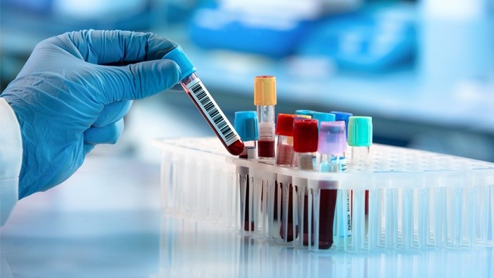 Phương pháp xét nghiệm máu hứa hẹn giúp chẩn đoán sớm bệnh Parkinson