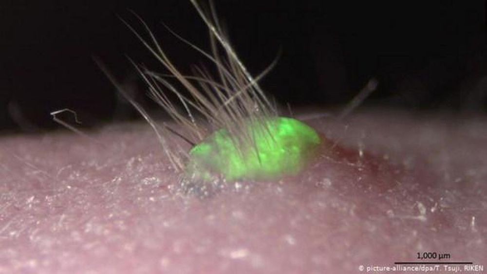 Các nhà khoa học Nhật Bản tìm ra tế bào gốc giúp tái tạo tóc
