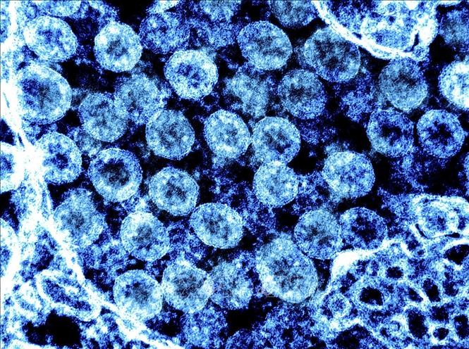 Virus SARS-CoV-2 chụp qua kính hiển vi điện tử trên mẫu bệnh phẩm tại phòng thí nghiệm. Ảnh: AFP/TTXVN