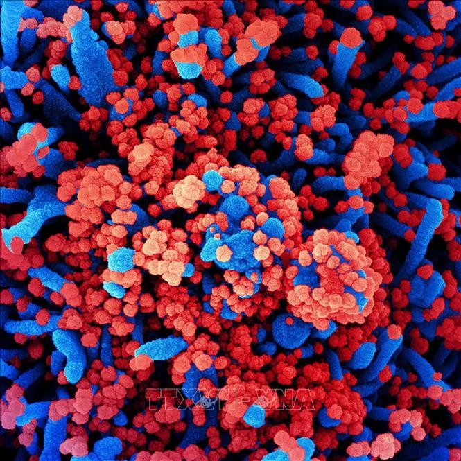 Hình ảnh quét qua kính hiển vi điện tử cho thấy một tế bào (màu xanh) bị virus SARS-COV-2 (màu đỏ) xâm nhập, lấy từ mẫu bệnh phẩm của bệnh nhân COVID-19 tại Viện Nghiên cứu Dị ứng và Bệnh Truyền nhiễm Quốc gia, Mỹ ngày 28/7/2020. Ảnh: AFP/TTXVN