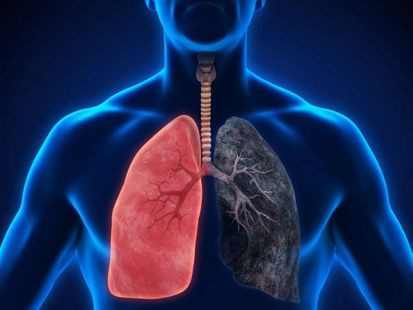Giới chuyên gia Mỹ: Cần thêm thử nghiệm đối với thuốc điều trị ung thư phổi của Innovent và Eli Lilly