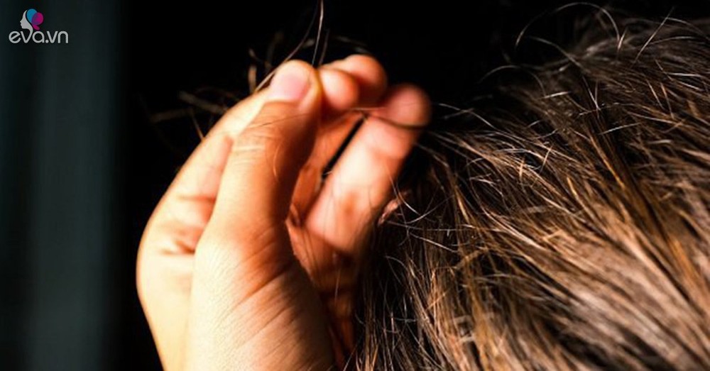 Bác sĩ khuyến cáo cách phát hiện, xử lý hành vi tự ăn tóc ở trẻ em