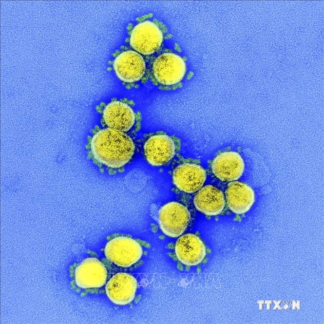 Hình ảnh quét qua kính hiển vi điện tử cho thấy virus SARS-COV-2 lấy từ mẫu bệnh phẩm của bệnh nhân COVID-19 tại Viện Nghiên cứu Dị ứng và Bệnh Truyền nhiễm Quốc gia, Fort Detrick, Maryland, Mỹ ngày 11/8/2020. Ảnh: AFP/TTXVN