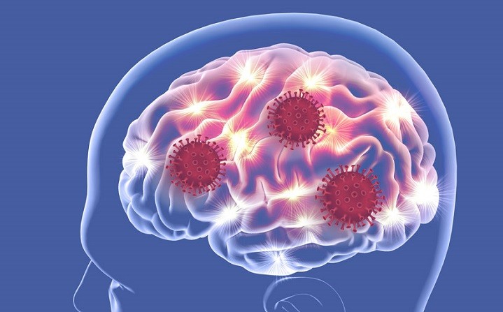 Virus SARS-CoV-2 tấn công vào não bộ con người. Ảnh: promegaconnections.com