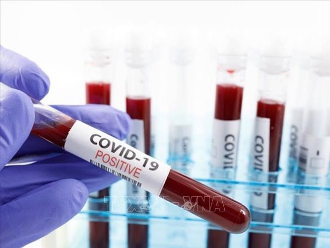 Kháng thể trong máu có thể giúp dự đoán bệnh COVID-19 nghiêm trọng
