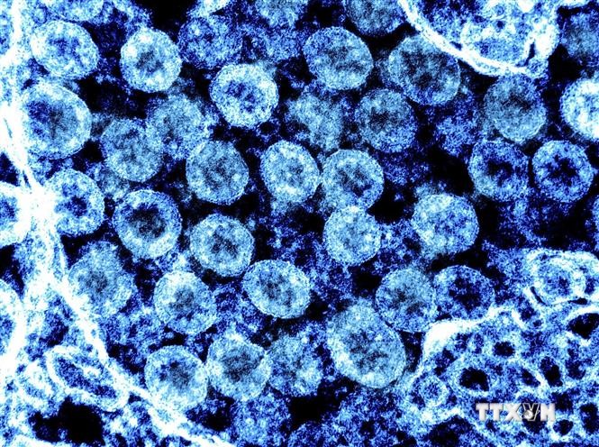 Hình ảnh quét qua kính hiển vi điện tử virus SARS-COV-2 lấy từ mẫu bệnh phẩm của bệnh nhân COVID-19 tại Viện Nghiên cứu Dị ứng và Bệnh Truyền nhiễm Quốc gia, Mỹ . Ảnh: AFP/TTXVN
