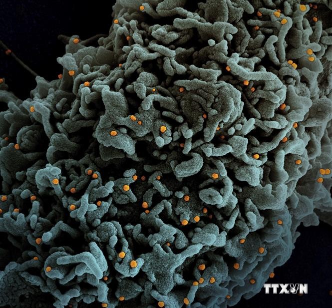 Hình ảnh quét qua kính hiển vi điện tử cho thấy tế bào (màu xanh) bị virus SARS-COV-2 (màu cam) xâm nhập, lấy từ mẫu bệnh phẩm của bệnh nhân COVID-19 tại Viện Nghiên cứu Dị ứng và Bệnh Truyền nhiễm Quốc gia, Mỹ ngày 31/3/2021. Ảnh: AFP/TTXVN
