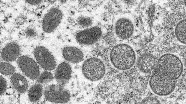 越南仍未发现候痘病例 但将随时应对猴痘疫情爆发的风险